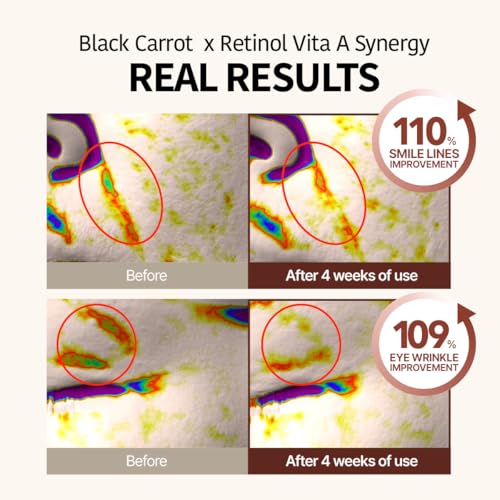GOODAL Black Carrot Retinol Cream 1.69 fl.oz (50ml) – Beginner Friendly Korean Skin Care Moisturizer with Retinol, Niacinamide, Pore minimizer – 48H Lasting Hydration, Anti-Aging, Daily Cream