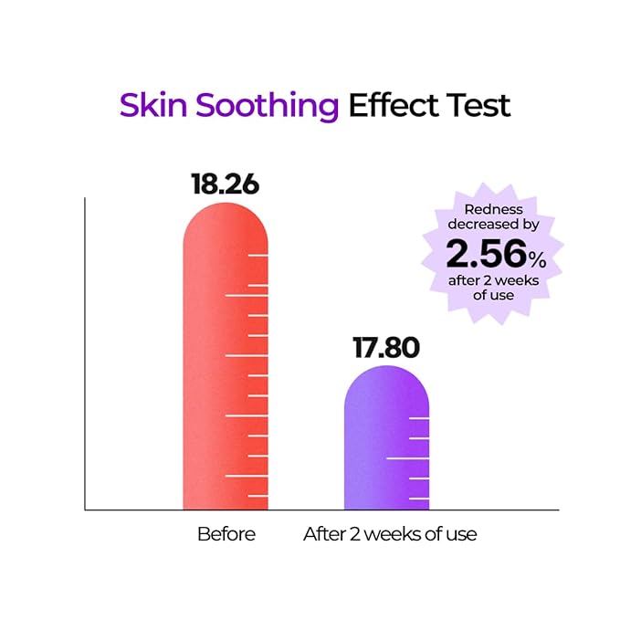 IZEZE Hyper CGA Cica Cream 1.69 fl.oz, 50ml | Centella Asiatica for Calming, Korean Skincare Cream for Soothing, Acne Prone Skin, Low Irritation for Sensitive Skin, Skincare Coreano