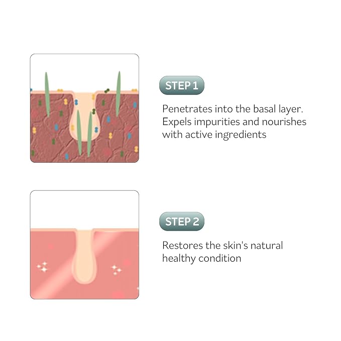 PESTLO Rejurecipe Spicule Roller Serum 50ml (1.69 fl oz) - Exfoliating & Hydrating Serum with Spicule Technology, Phyto-PDRN for Face, Neck, Décolleté with Gua Sha