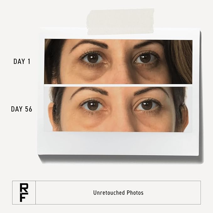 RODAN + FIELDS Active Hydration Bright Eye Complex | 15ml | Moisturizing Under Eye Cream for Dry Skin | Eye Treatment for Refreshed Appearance | Skincare