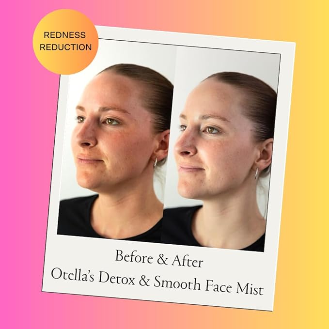 Detox & Soothe Face Mist with Hypochlorous Acid .02% | Reduces Redness & Prevents Breakouts | Balancing & Soothing Toner | Removes Sweat & Oil | Fine Mist | Clean Ingredients | TSA Approved, 2.7 oz