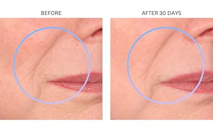 Consult Beaute XTERNA-Q Anti-Aging Universal Day and Night CoQ10 Cream - Peptide Q10 & Niacinamide Face Moisturizer for Dry Skin - Restore Skin Barrier - Visibly Reduce Lines & Wrinkles - 1 Fl Oz