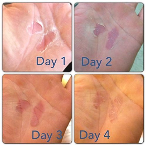 Hand Tear Repair - Rip Fix Stopper Balm for Gymnastics - Climbers Hand Balm - Wod Callus Hand Care - Climbing Hand Repair Balm Cream - Treatment for Cracked or Ripped Hands 0.3 oz - Pack of 3