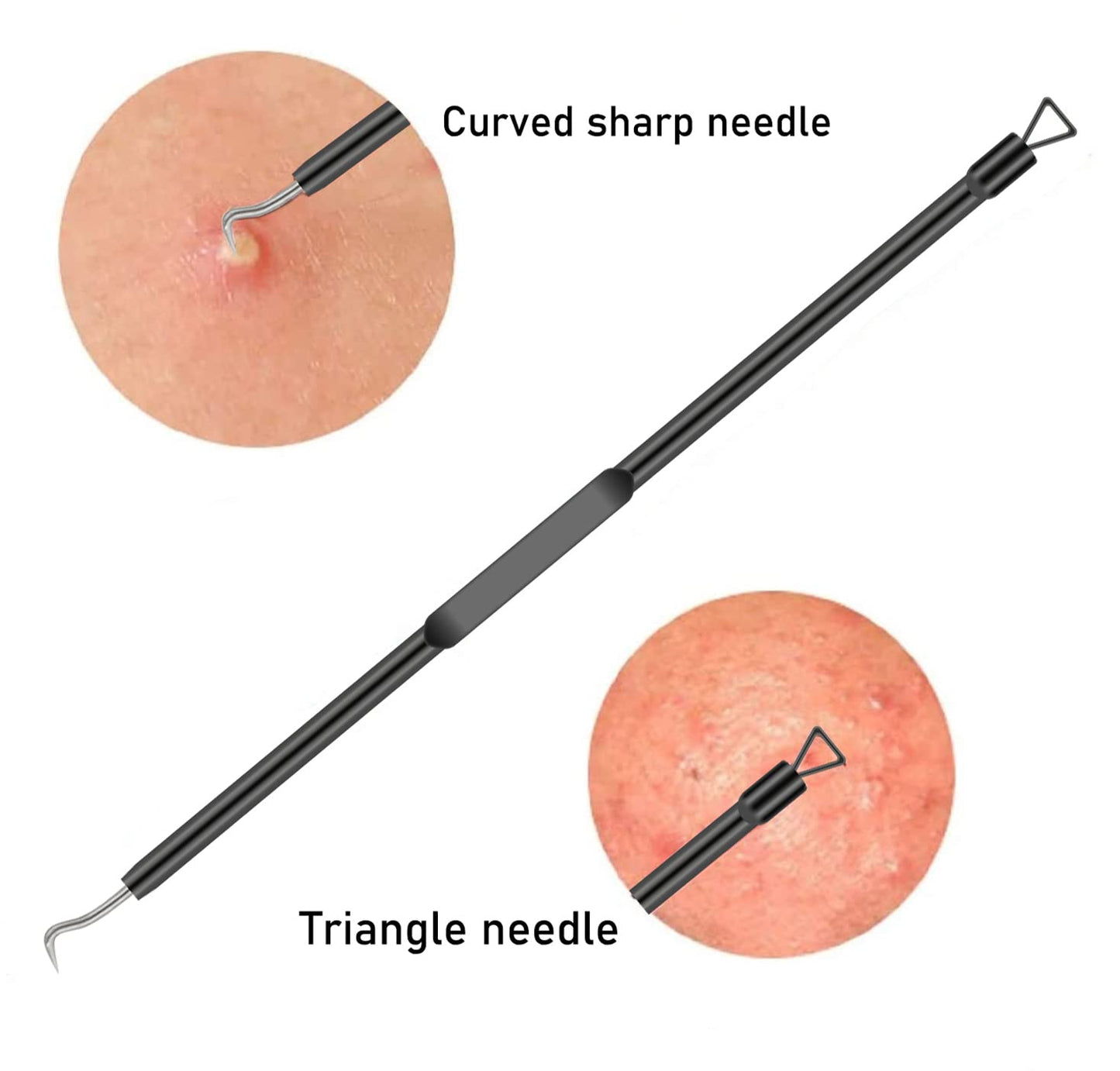 Blackhead Remover Pimple Popper Tool Kit 4 Pcs Acne Comedone Zit Blackhead Extractor Tool for Nose Face,Stainless Steel Whitehead Popping Removal Tool Set