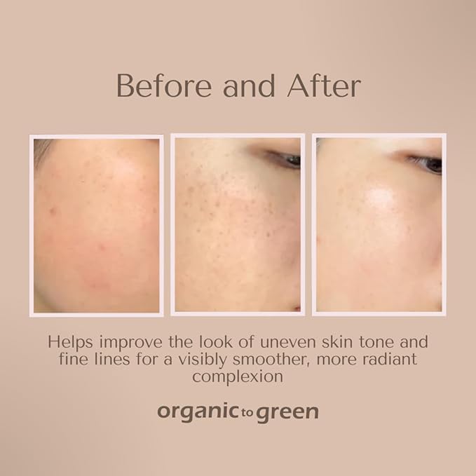 Organic To Green Kojic Turmeric Soap for Dark Spots - Infused with Hyaluronic Acid, Retinol, Vitamin E, Shea Butter, Collagen (3 Pack - Lemon, Fresh Ginger, and Lavender Scent)