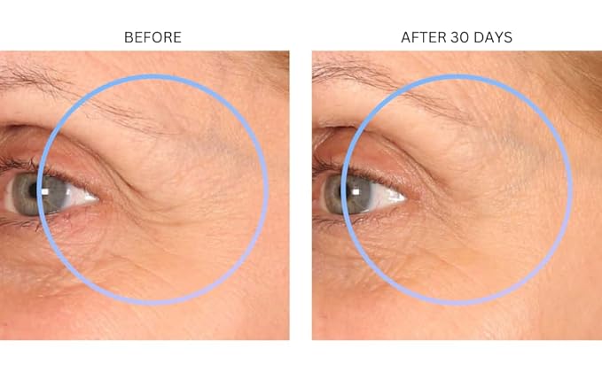 Consult Beaute XTERNA-Q Anti-Aging Universal Day and Night CoQ10 Cream - Peptide Q10 & Niacinamide Face Moisturizer for Dry Skin - Restore Skin Barrier - Visibly Reduce Lines & Wrinkles - 1 Fl Oz