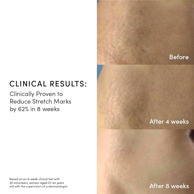 Evereden Golden Belly Serum, 1.7 fl