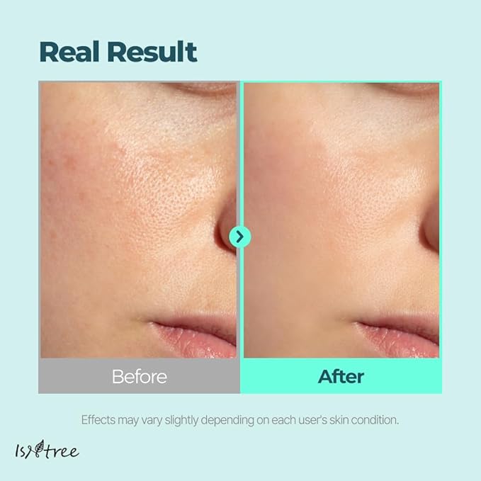 ISNTREE Gim PDRN Hydro Bouncy Ampoule 50ml, 1.69 fl oz | Korean SEAWEED Skincare Facial Serum | Water Jelly Texture | Hydrating & Firming | Multi-Hyaluronic Acid + Collagen Boost | Pore-Refining Glow