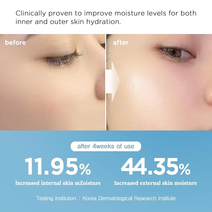 Nightingale Ecto-Hyaluronic Cream with 8 layer Hyaluronic Acid, Ectoin, Daily Face Moisturizer For Dry Skin, Fragrance Free, Hypoallergenic, Allergen Free, Cruelty Free, Vegan, Korean Skin Care