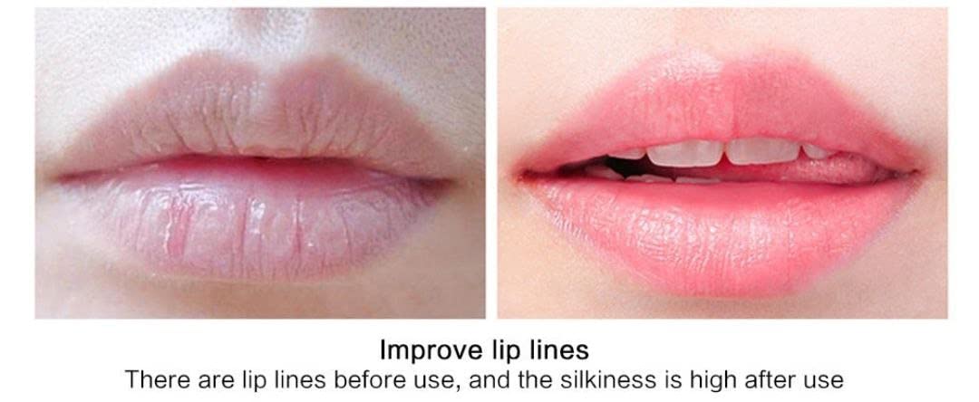 NUOVADERM Collagen Lip Mask with Squalane - Moisture & Collagen Boosting Lip Sleeping Mask for Soft and Supple Lips - Lip Plumper Balm to Restore, Nourish & Hydrate Dry Chapped Lips