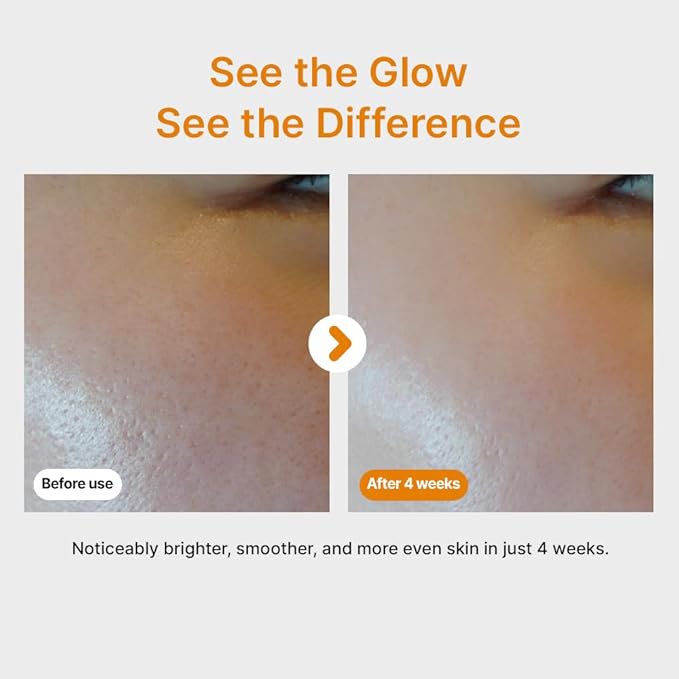 Pure Vitamin C Serum - Korean Skin Care with Vitamin 10.5% Concentrated, No Added Water, Airless Special Pump, Brightening and Firming Skin, Improving Uneven and Dull Skin Tone, 30ml/1.01fl.oz.
