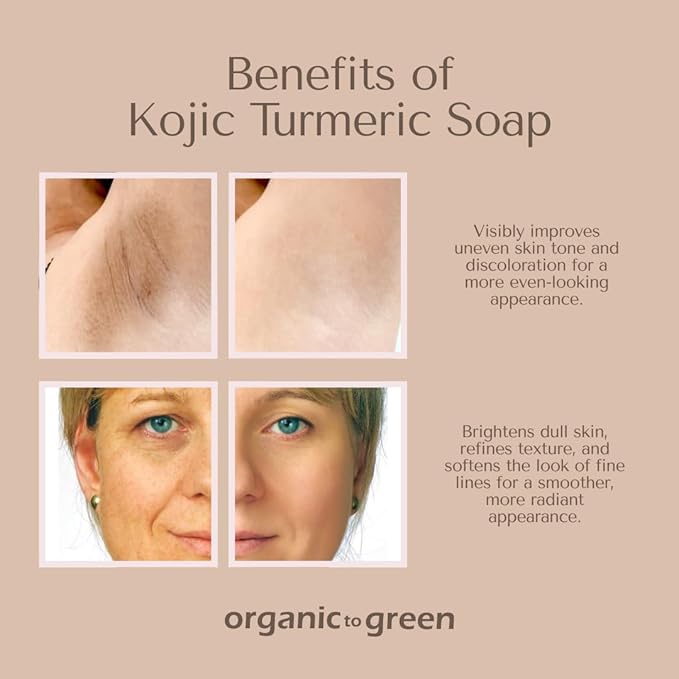 Organic To Green Kojic Turmeric Soap for Dark Spots - Infused with Hyaluronic Acid, Retinol, Vitamin E, Shea Butter, Collagen (3 Pack - Lemon, Fresh Ginger, and Lavender Scent)