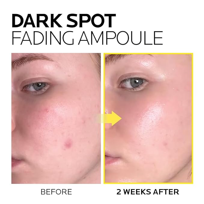 MIMUMIMU Dark Spot Remover for Face | Korean Clinic Skincare - Thioctic Acid 0.01% & Niacinamide 10% | Overnight Treatment for Melasma, Hyperpigmentation, Discoloration, Acne Scars | 15ml /0.33 Fl Oz