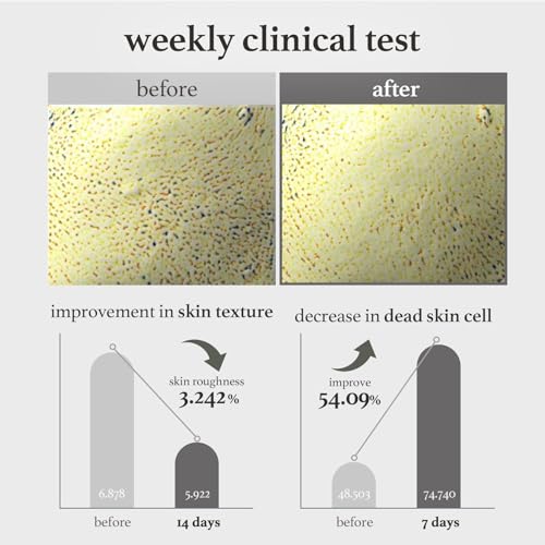 NOONI Facial Toner Pads - Glycolic Acid Exfoliating Pads 80 EA | AHA(Glycolic Acid, Lactic Acid), Pore Pad, Glass Skin, Reduces Fine lines with Panthenol & Hydrating Serum, Korean Skin Care, Kbeauty