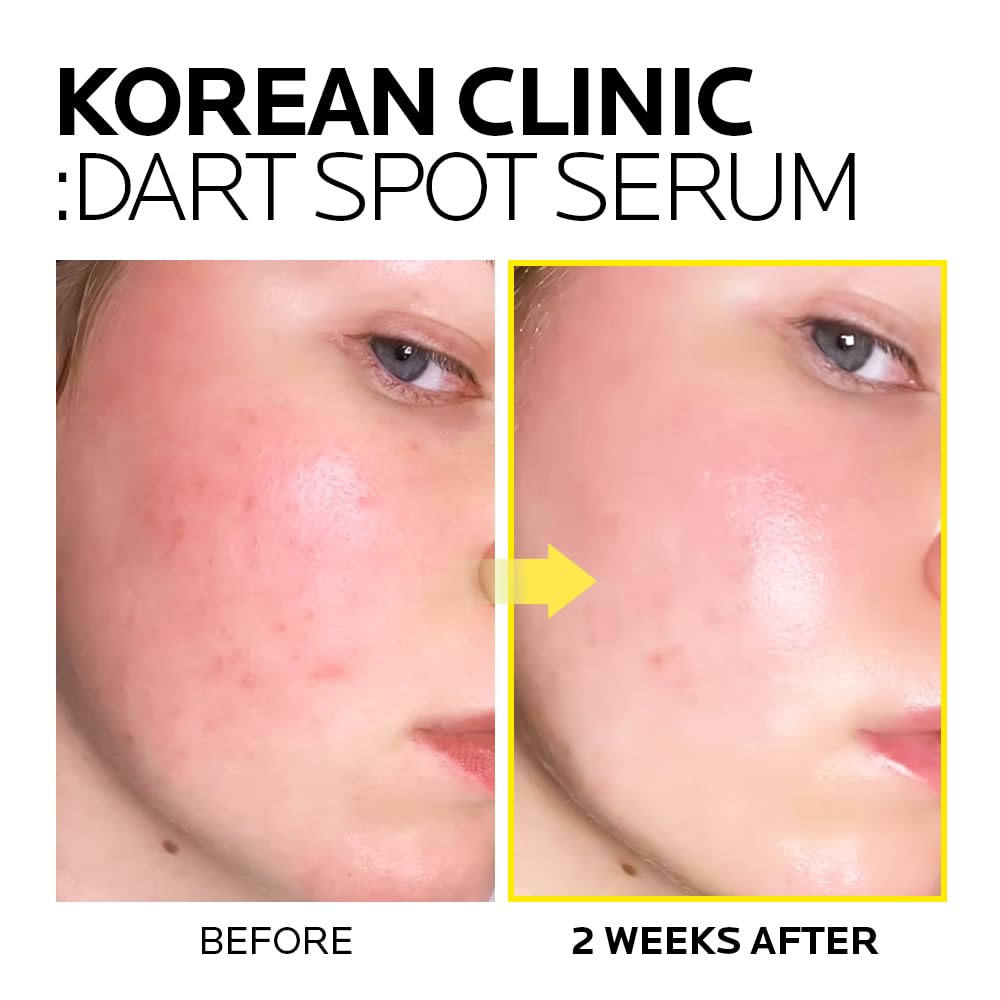 MIMUMIMU Dark Spot Remover Serum for Face | Korean Clinic Skincare - Thioctic Acid 0.01% & Niacinamide 5% | Spot Treatment for Melasma, Hyperpigmentation, Discoloration, Acne Scars | 30ml/1.01 fl.oz