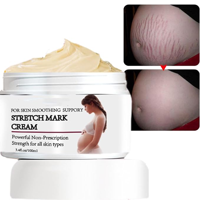 Stretch Mark Prevention Cream for Pregnancy,