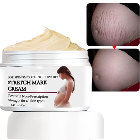 Stretch Mark Prevention Cream for Pregnancy,