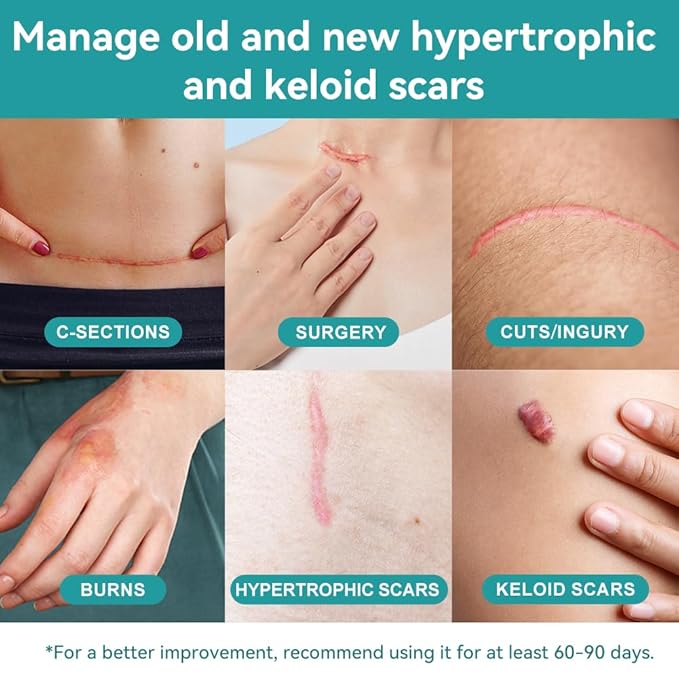 Dimora Medical Grade Silicone Scar Sheets - Ultra Soft Silicone Scar Tape (1.6”x120" Roll), Waterproof Scar Treatment for Surgical Scars, C Section, Tummy Tuck, Keloid Treatment