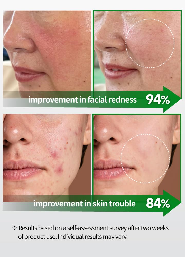 BEAUDIANI CICA Ampoule Toner Pads – 100 Pre-Soaked Facial Pads with Centella Asiatica, Hyaluronic Acid & Peptides | Korean Skincare for Sensitive Skin, Hydrating & Soothing