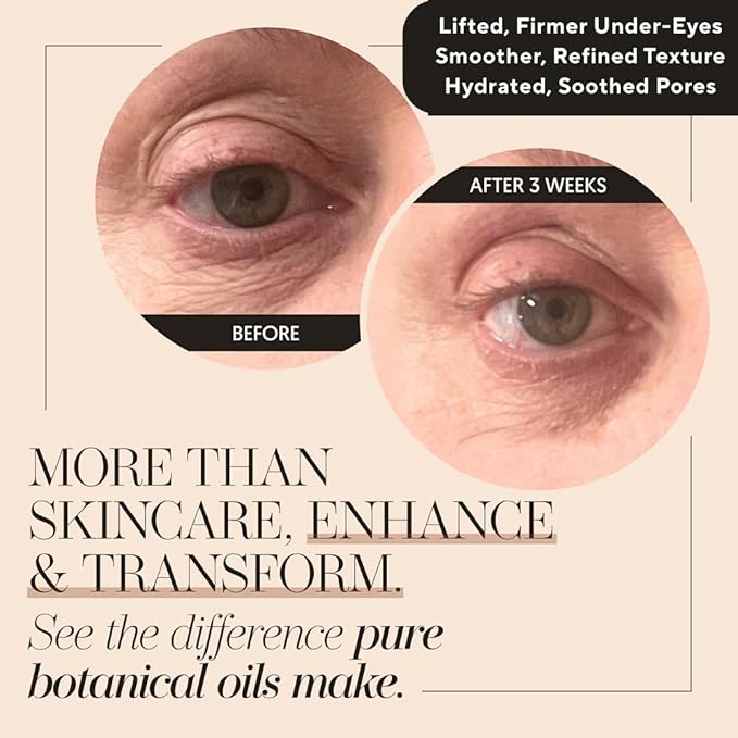 100% Organic Tsubaki Face Oil & Under-Eye Serum. With Jojoba, Calendula, & Rice Bran - Hydrating & Brightening for Glowing Skin, Dark Spots & Even Skin Tone, Moisturizing Anti Aging Serum by Finally