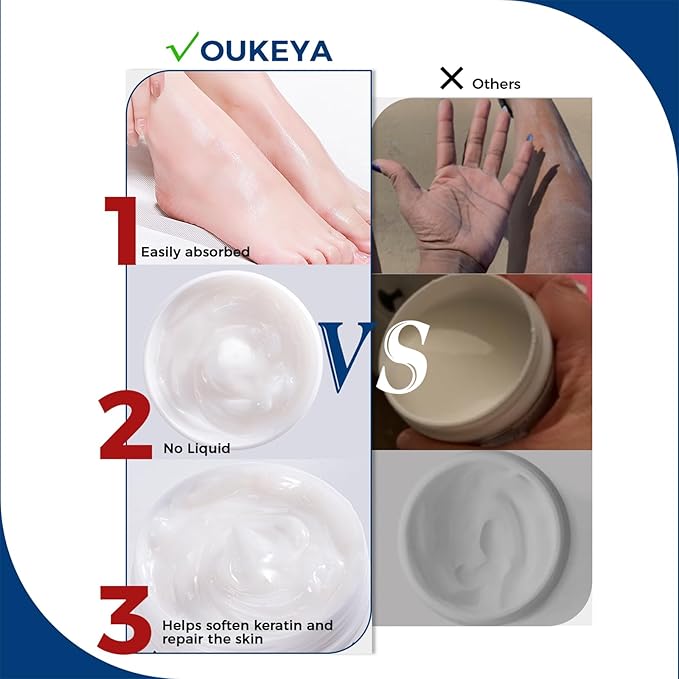 OUKEYA NEW FORMULA Urea Cream 40% Plus 2% Salicylic Acid for Feet Maximum Strength, Dry Cracked Hand Heel Moisturizing Repair Lotion for Knees, Elbows, Removes Corns, Dead Skin Cream, 5.29 oz