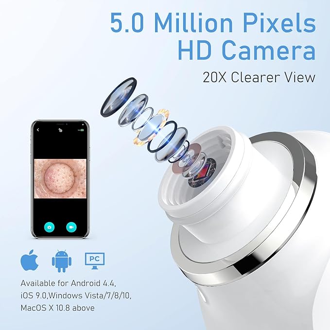 Facial Pore Blackhead Remover Vacuum, 1080P Camera Blackhead Remover, 20x Zoom, 8 LEDs ＆ 3 Suction Modes, 800mAh Battery & USB - 6 Heads Pore Cleaner Kit for Women&Men(Green)