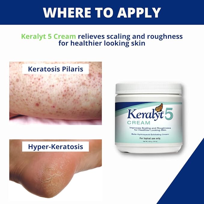 5 Psoriasis Cream - Full Body 5% Salicylic Acid Exfoliating Skin Lotion - Promotes Relief from Itchy, Redness, Dryness, Roughness, and Flakey Skin
