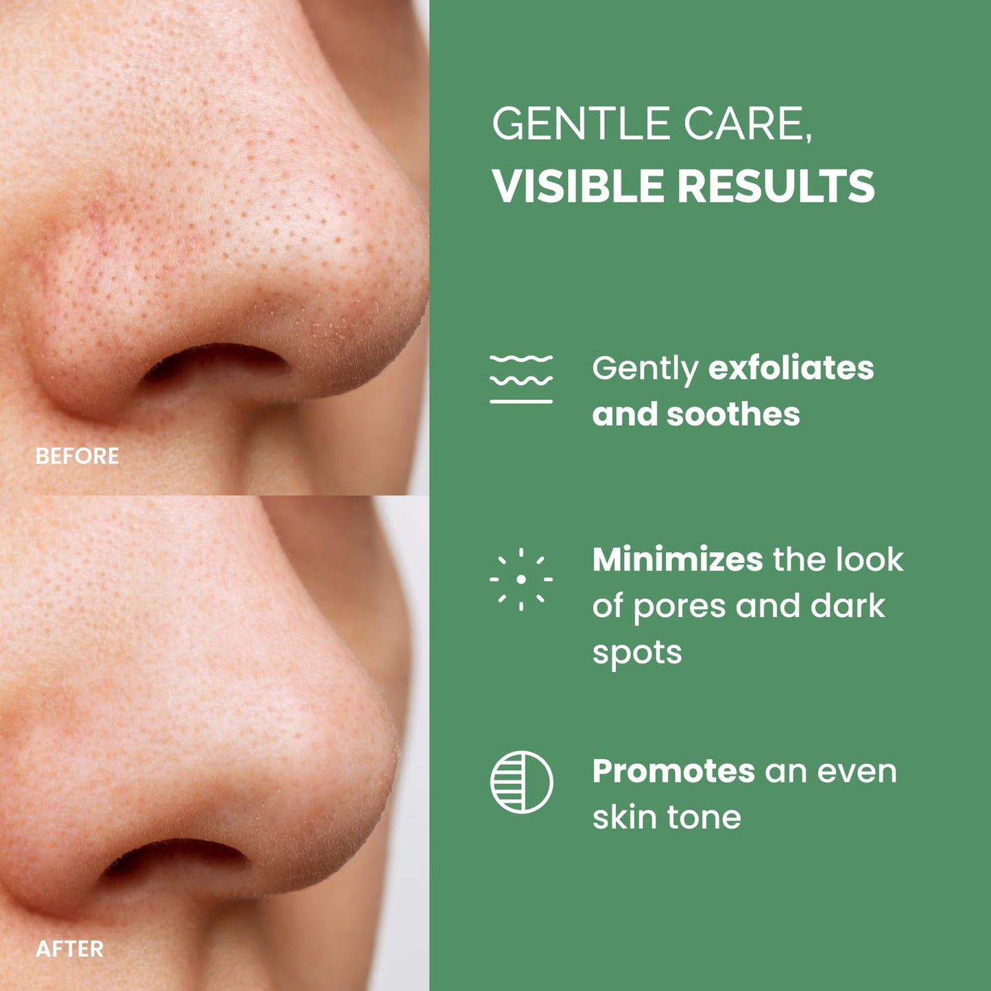 DERMAL Retinol Peptide Lifting Pad - Korean Toner Pad for Anti-Aging & Wrinkles with Bakuchiol - Vegan Pure Cotton Square Pads - Travel Kit 12 Pads, 3 Pack (Total 36 Pads)