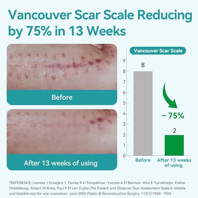 Dimora Medical Grade Silicone Scar Sheets -Ultra Soft Silicone Scar Tape (1.6”x60" Roll), Hypoallergenic Scar Removal Treatment for Surgical Scars, C Section, Tummy Tuck, Keloid Treatment