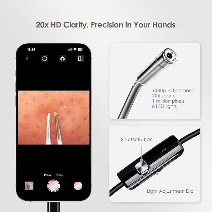 Luma 1 Visual Blackhead Remover Tweezers with Camera - Pimple Popper Tool with Camera 20x Magnification, 1080P, 8 LED Lights, with 2* Alloy Steel Tweezers and Blackhead & Pimple Popper Tool Kit (6ps)