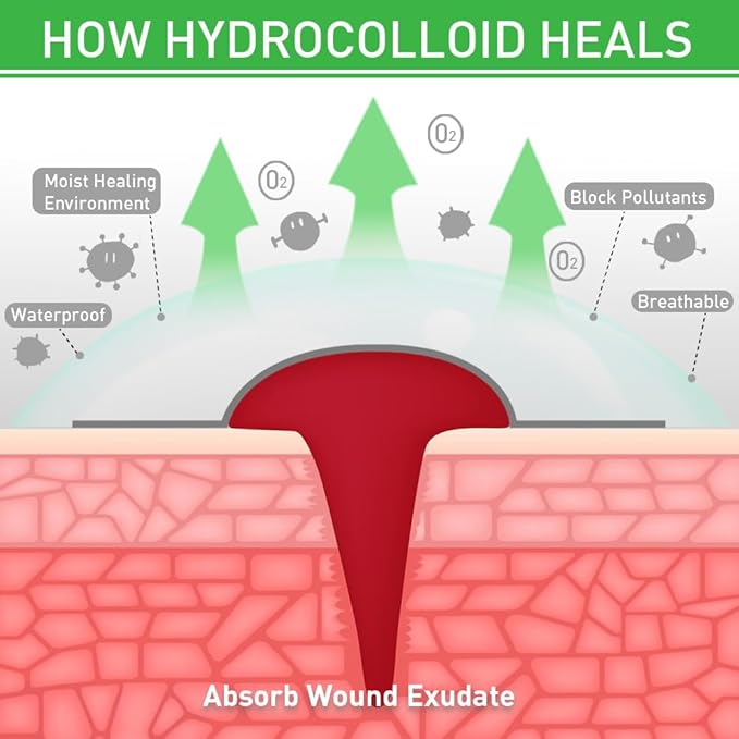 Hydrocolloid Bandages,Hydrocolloid Roll for Wound Care Large hydrocolloid Bandages Patch with Self-Adhesive Waterproof Ultra Absorbent Flexible DIY Size & Shape First Aid Kit Essential (2in*12ft)