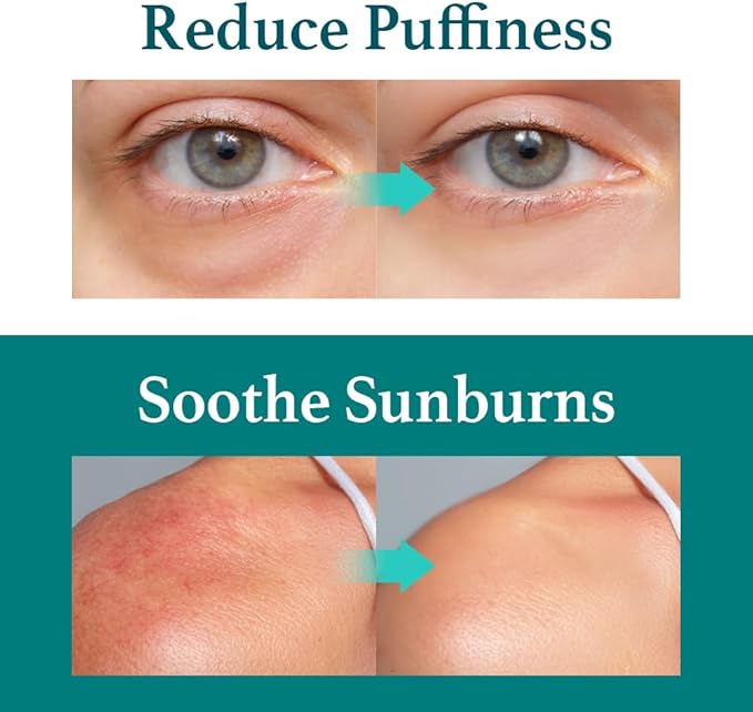 Ice Sorbet Toner Pads | Skin Prep Wipes for Puffiness, Under Eye Bags & Instant Face Lift | Gel Pads for Sunburn Relief & After Sun with 30% Glacier Water & Caffeine | Pack of 3 (180 Count)