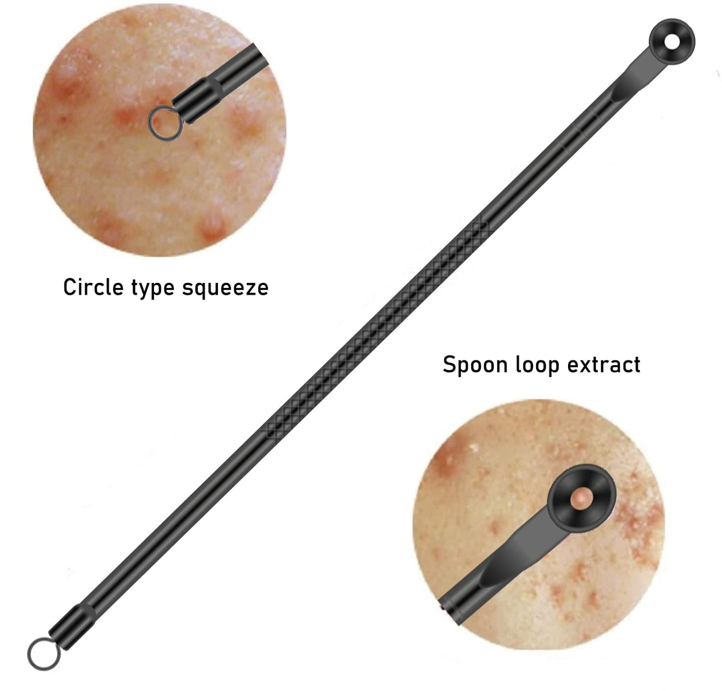 Blackhead Remover Pimple Popper Tool Kit 4 Pcs Acne Comedone Zit Blackhead Extractor Tool for Nose Face,Stainless Steel Whitehead Popping Removal Tool Set