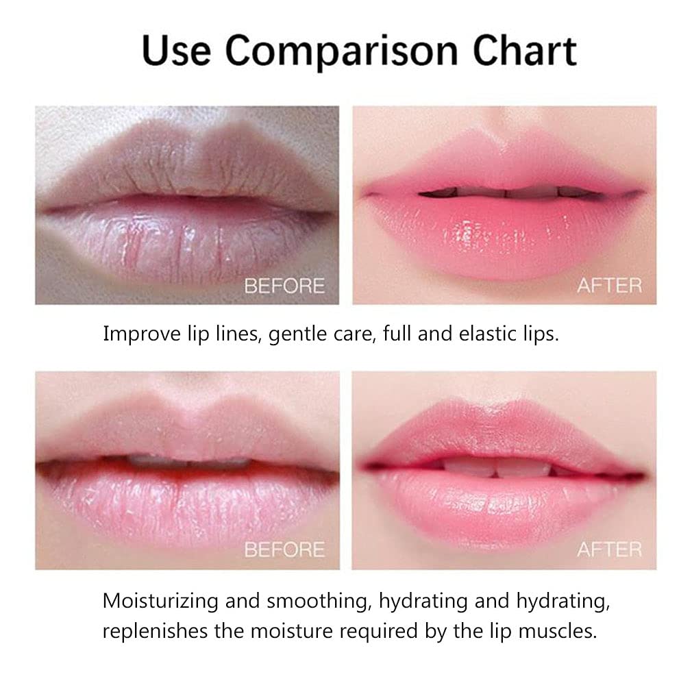 20Pcs Moisturizing/Plumping Lip Mask, Restores Moisture Mask for Dry Lips and Lines Overnight Care, Gel Treatment Masks  (Pink)