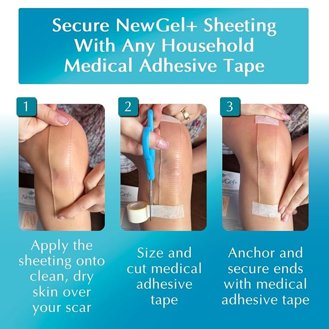 Advanced Silicone Scar Treatment Sheets for OLD, NEW Scars, Surgery, Keloids, C-Section, Burns, by NewGel Plus by MyNewGel, 1" x 6" Sheet (4 Count) - BEIGE