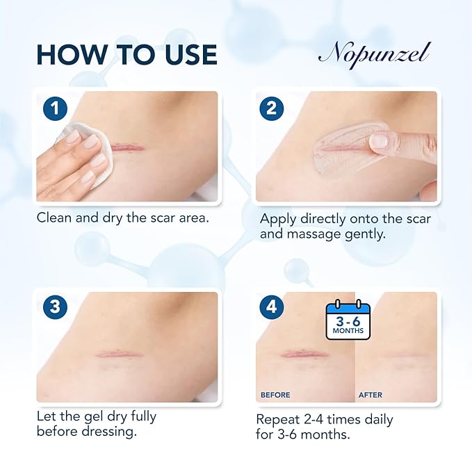 Silicone Scar Gel: Silicone Gel for Scars - Improve Scar Appearance for Old and New Scars - Medical Grade Silicone - Advanced Scar Gel - Scalds - Surgery - Injury - Stitches - Burns - 20g