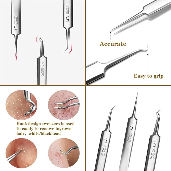 Professional Blackhead Remover Pimple Popper Tool,Comedones Extractor Acne Removal Tweezers for Blemishs，Whitehead Popping,Zit Removing for Nose Face,Stainless Steel Makeup Tool