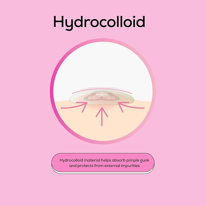 Hanhoo EraseZit Magnesium Microneedle Patch, 8 Microneedle Patches, Hydrocolloid Pimple Patches, For Deep Pimples, Calms Angry Zits, Acne Spot Patches, Microdot Pimple Patches, Korean Skincare