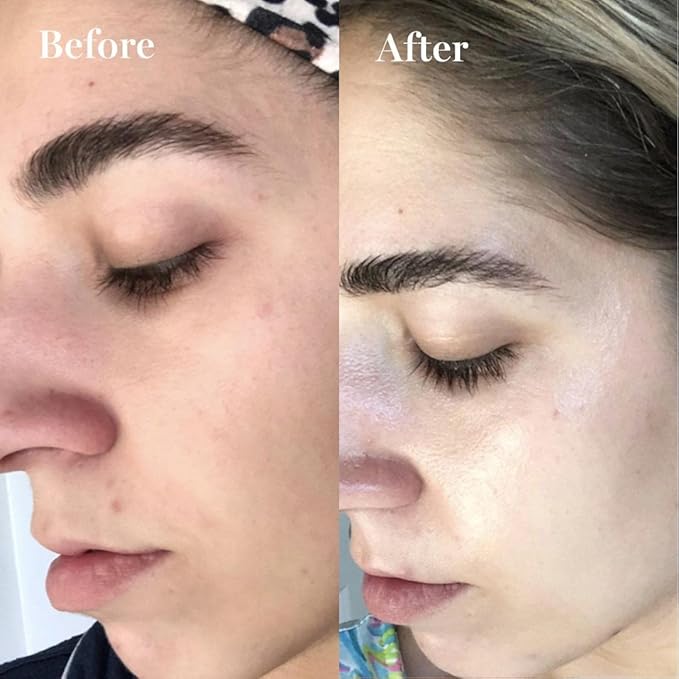 Saturday Skin Face Moisturizing Cream with Carrot, Niacinamide, Ceramides & Centella Asiatica, Peptide, Paraben-Free, Sulfates-Free, Fragrance-Free, Anti Wrinkle Facial Cream(1.61 Ounce)