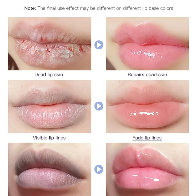 Lip Repair Gel, Moisturizing Lip Repair Balm.