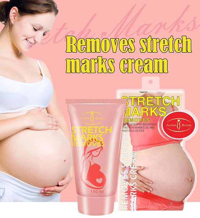 AICHUN BEAUTY Pregnancy Cream Streach Mark 150ml