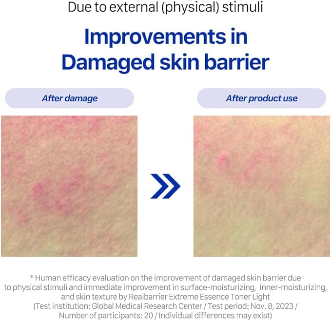 Real Barrier Extreme Essence Toner Light 6.76 Fl Oz | Hyaluronic Acid Panthenol Face Moisturizer for Sensitive Dry Skin | Soothing & Hydrating Moisturizing Toner for Face | Korean Skin Care