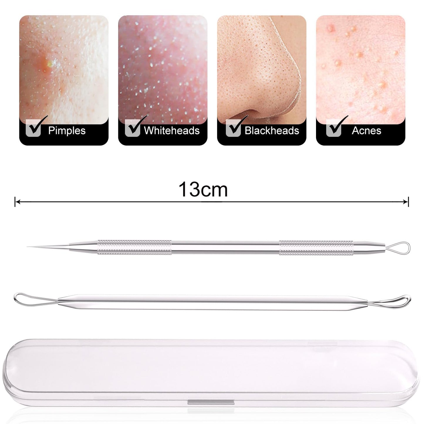 Azosowo 2-Pack Pimple Extractor Tools, Blackhead Remover Tools, Blackhead Extractor, Pimple Popper Tool Kit for Zit, Comedone, Acne, Whitehead - with Case