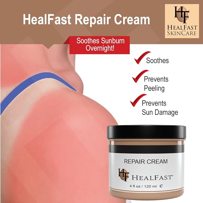 Sensitive Skin Repair Moisturizing Cream 4 Oz – For Dry, Itch– Fights Rashes, Dryness, Stretch Marks, Sunburn and Bed Sores – Herbal and Food Based Ingredients