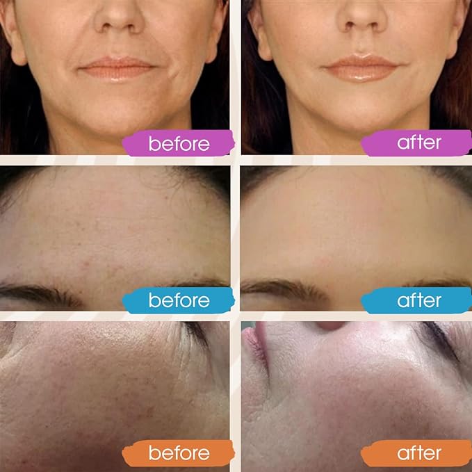 Retinol Serum for Face, Vitamin C with Hyaluronic Acid Face Serum for Women and Men, Glow Total Package Skin Care Set, Targets Appearance of Uneven Skin Tone and Dryness 3x2 oz
