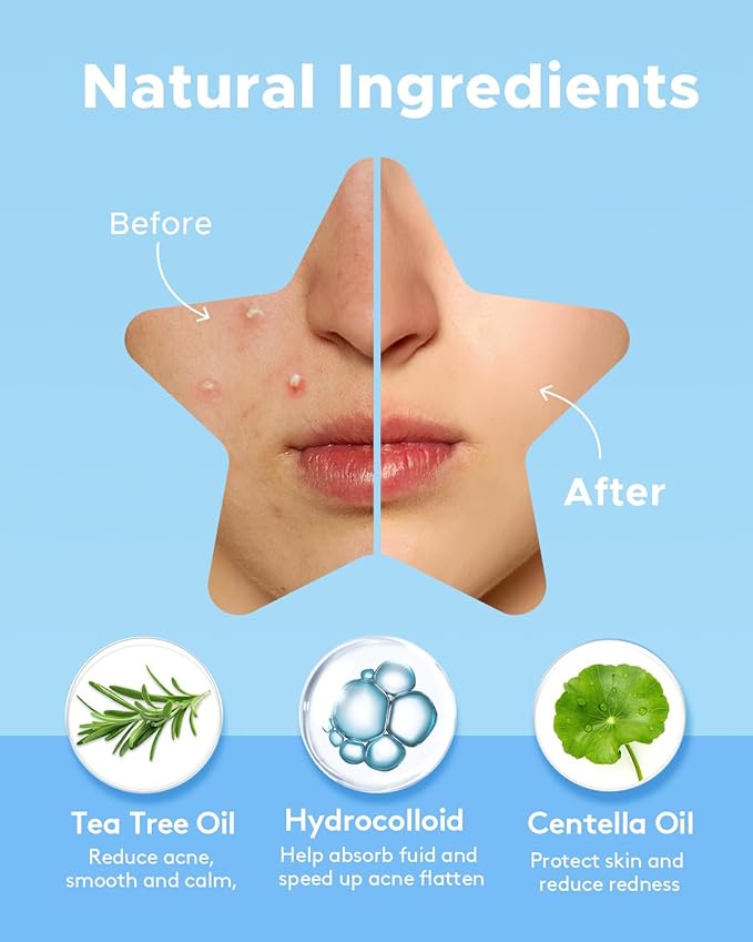 LitBear Acne Pimple Patch, 6 Colors 168 Dots Star Pimple Patches with Tea Tree Oil & Centella Oil, Hydrocolloid Acne Patches for Face Cute Zit Patches Pimple Stickers Acne Dots