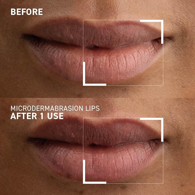 Dr. Brandt Microdermabrasion Smoothing Lip Scrub oz