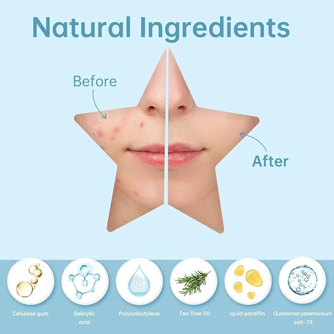 200 Counts Star Pimple Patches for Face, Hydrocolloid Acne Pimple Patches with Tea Tree Oil for Party Gift Covering Zits Blemishes