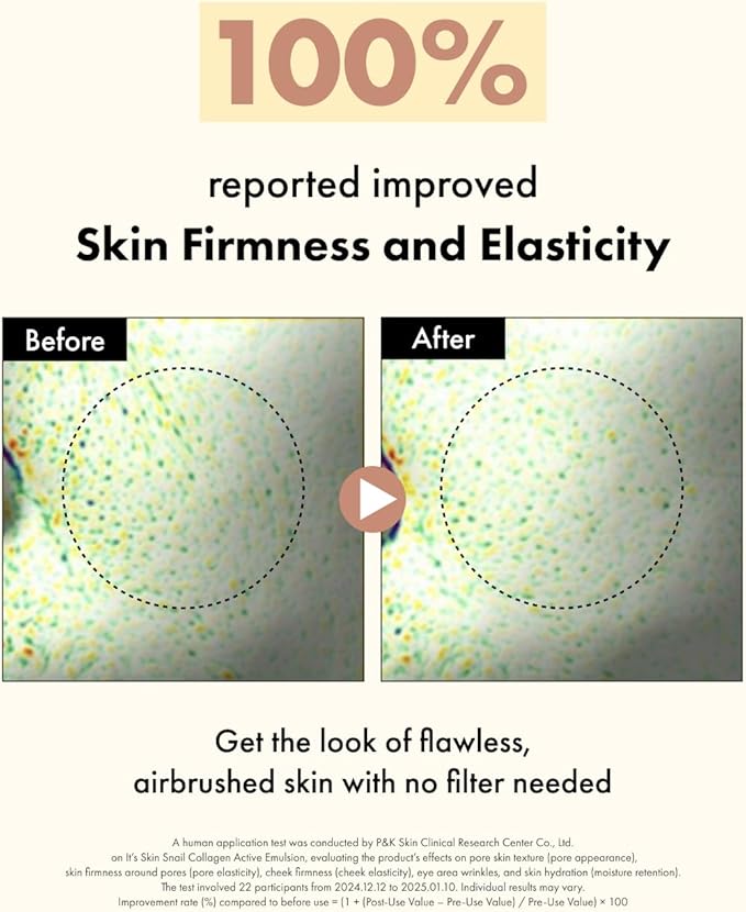 It'S SKIN Snail Collagen Active Toner 4.05 Fl Oz, Hydrating & Firming Facial Toner with Snail Mucin, Dual Collagen, and PHA – Pore-Refining, Gentle Formula for Smooth Skin, Korean Skincare