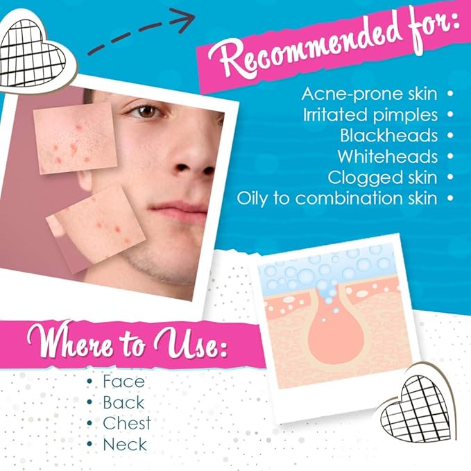 Bye Bye Blemish Acne Drying Lotion, On-the-Spot Pimple Treatment, Reduce Pimples Overnight, Beauty Skincare Essential - 1oz. (2-Pack)